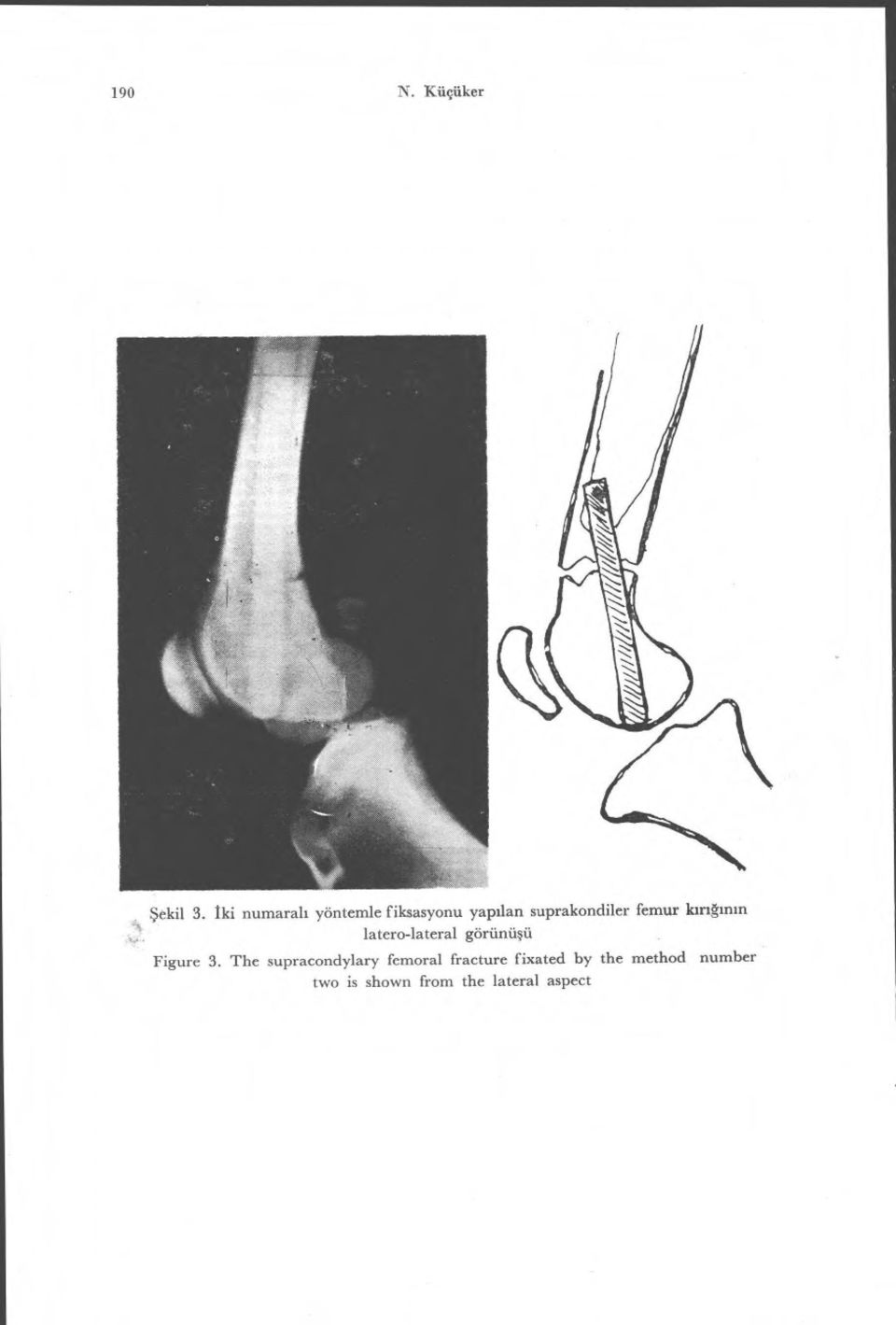 femur lar ıg ın ın latero-lateral görünü şü Figure 3.