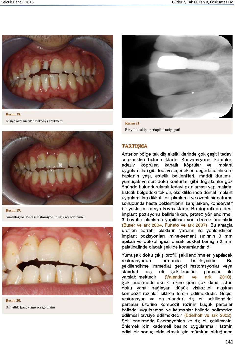 Konvansiyonel köprüler, adeziv köprüler, kanatlı köprüler ve implant uygulamaları gibi tedavi seçenekleri değerlendirilirken; hastanın yaşı, estetik beklentileri, maddi durumu, yumuşak ve sert doku