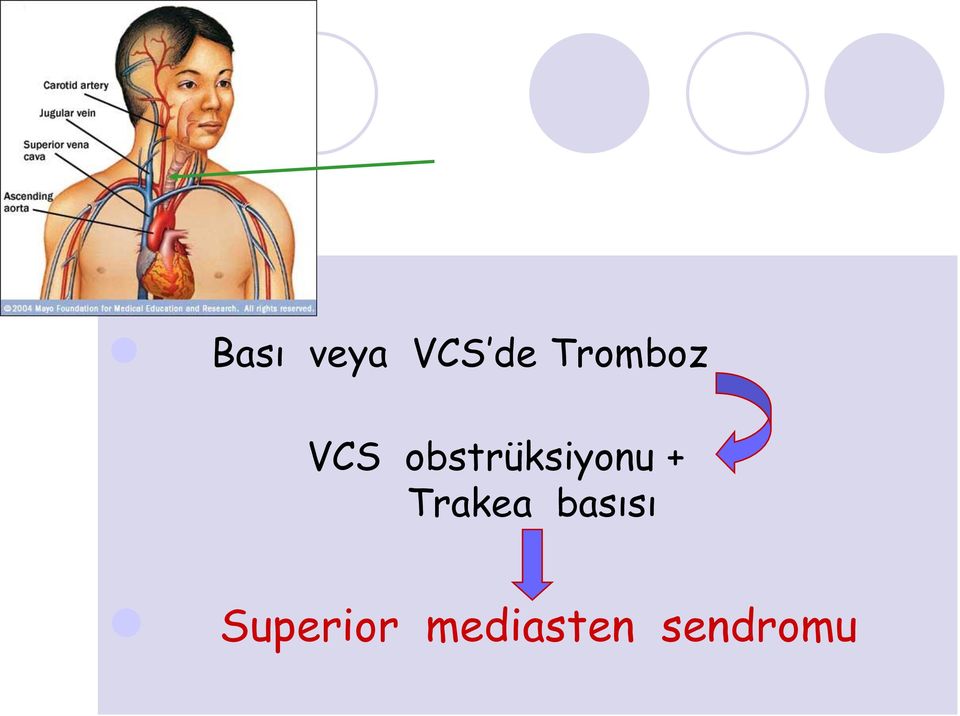 obstrüksiyonu +