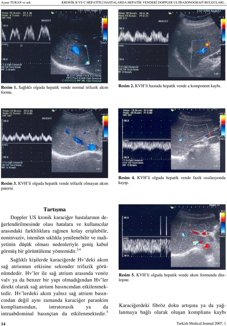 14 Tartışma Doppler US kronik karaciğer hastalarının değerlendirilmesinde olası hatalara ve kullanıcılar arasındaki farklılıklara rağmen kolay erişilebilir, noninvaziv, istenilen sıklıkla