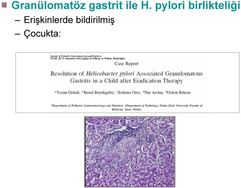 pylori birlikteliği