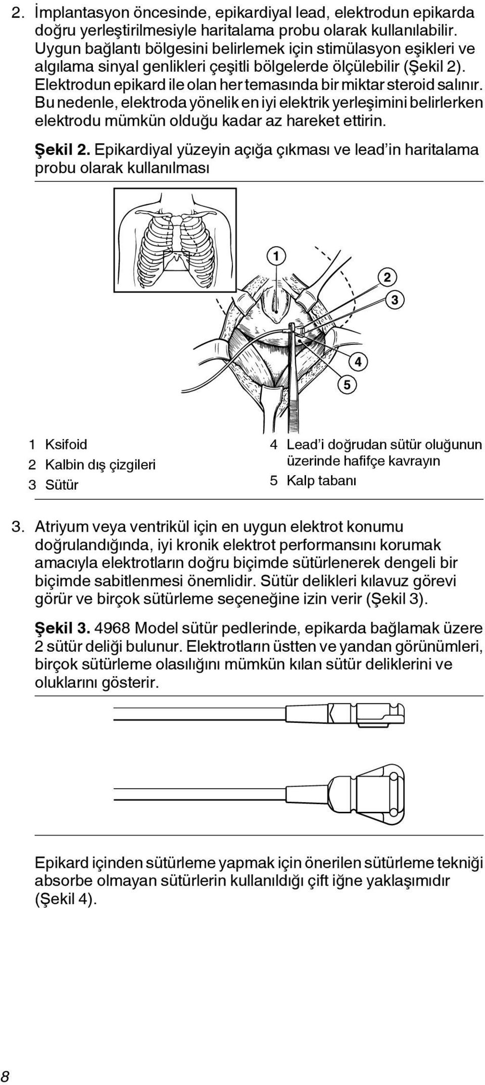 Elektrodun epikard ile olan her temasında bir miktar steroid salınır. Bu nedenle, elektroda yönelik en iyi elektrik yerleşimini belirlerken elektrodu mümkün olduğu kadar az hareket ettirin. Şekil 2.