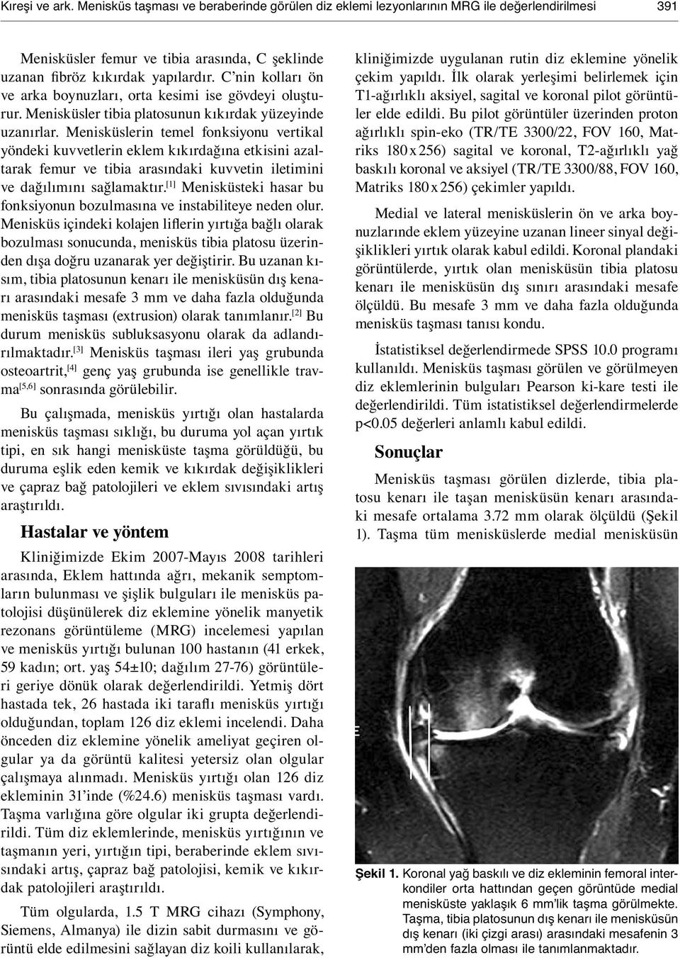 Menisküslerin temel fonksiyonu vertikal yöndeki kuvvetlerin eklem kıkırdağına etkisini azaltarak femur ve tibia arasındaki kuvvetin iletimini ve dağılımını sağlamaktır.