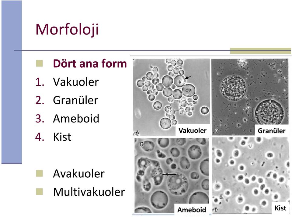 Ameboid Kist Vakuoler Granüler