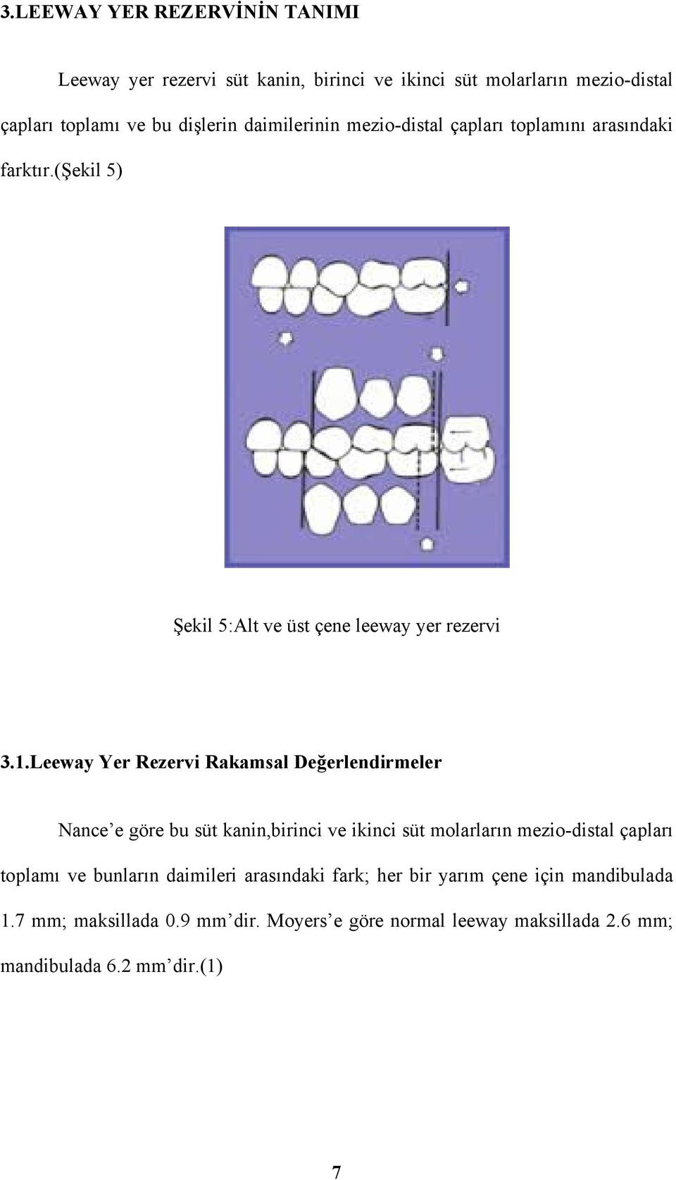 Leeway Yer Rezervi Rakamsal Değerlendirmeler Nance e göre bu süt kanin,birinci ve ikinci süt molarların mezio-distal çapları toplamı ve