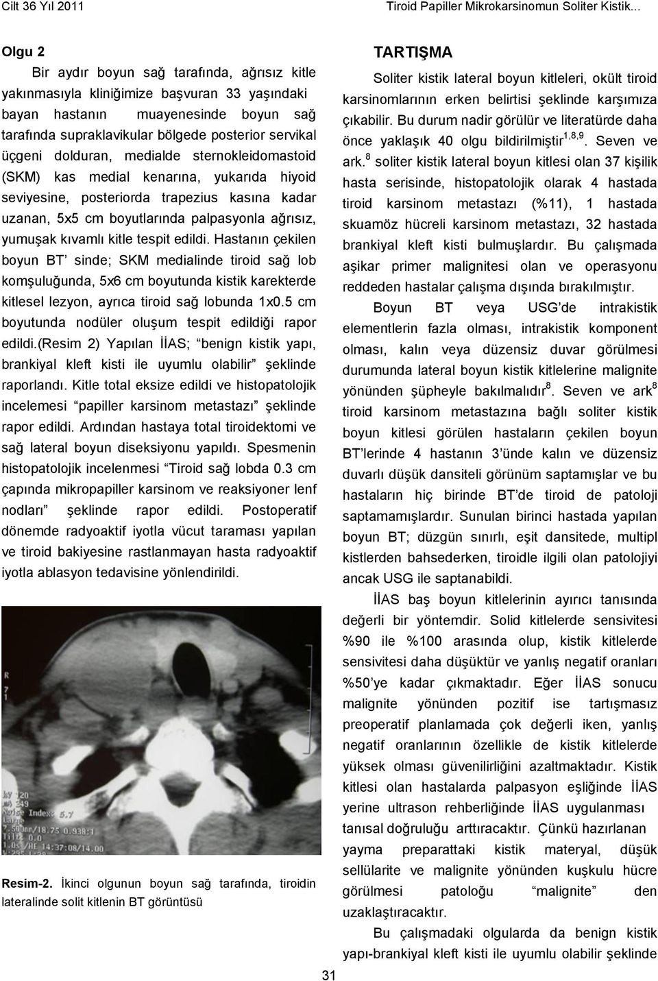 tespit edildi. Hastanın çekilen boyun BT sinde; SKM medialinde tiroid sağ lob komşuluğunda, 5x6 cm boyutunda kistik karekterde kitlesel lezyon, ayrıca tiroid sağ lobunda 1x0.