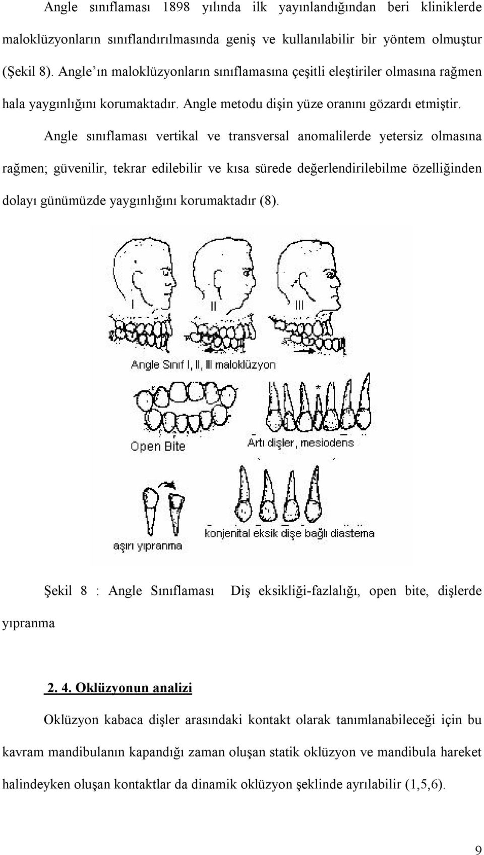 Angle sınıflaması vertikal ve transversal anomalilerde yetersiz olmasına rağmen; güvenilir, tekrar edilebilir ve kısa sürede değerlendirilebilme özelliğinden dolayı günümüzde yaygınlığını