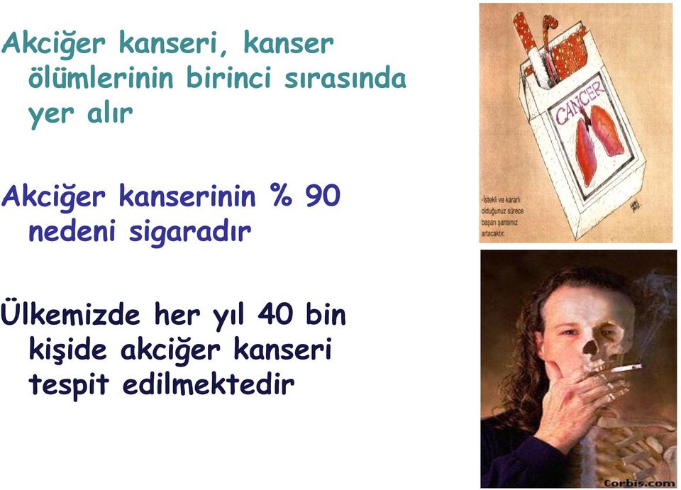 kanserinin % 90 nedeni sigaradır Ülkemizde