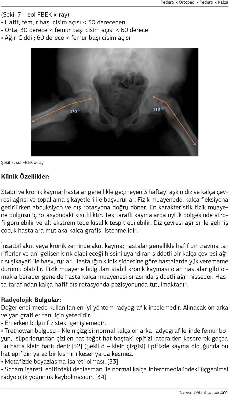 Fizik muayenede, kalça fleksiyona getirilirken abduksiyon ve dış rotasyona doğru döner. En karakteristik fizik muayene bulgusu iç rotasyondaki kısıtlılıktır.