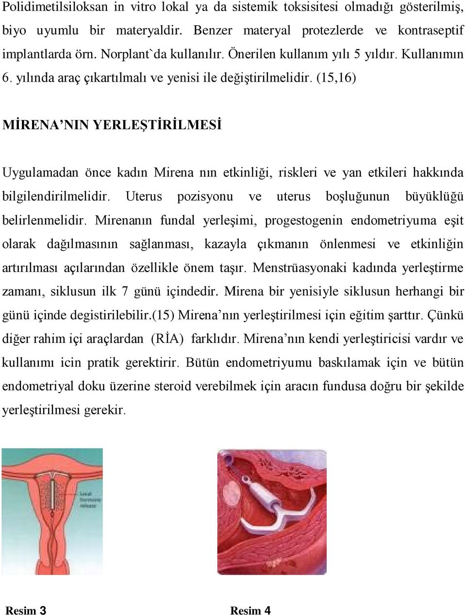 (15,16) MİRENA NIN YERLEŞTİRİLMESİ Uygulamadan önce kadın Mirena nın etkinliği, riskleri ve yan etkileri hakkında bilgilendirilmelidir. Uterus pozisyonu ve uterus boşluğunun büyüklüğü belirlenmelidir.