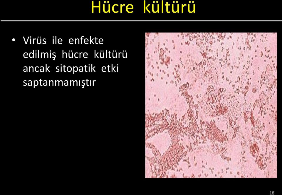 hücre kültürü ancak