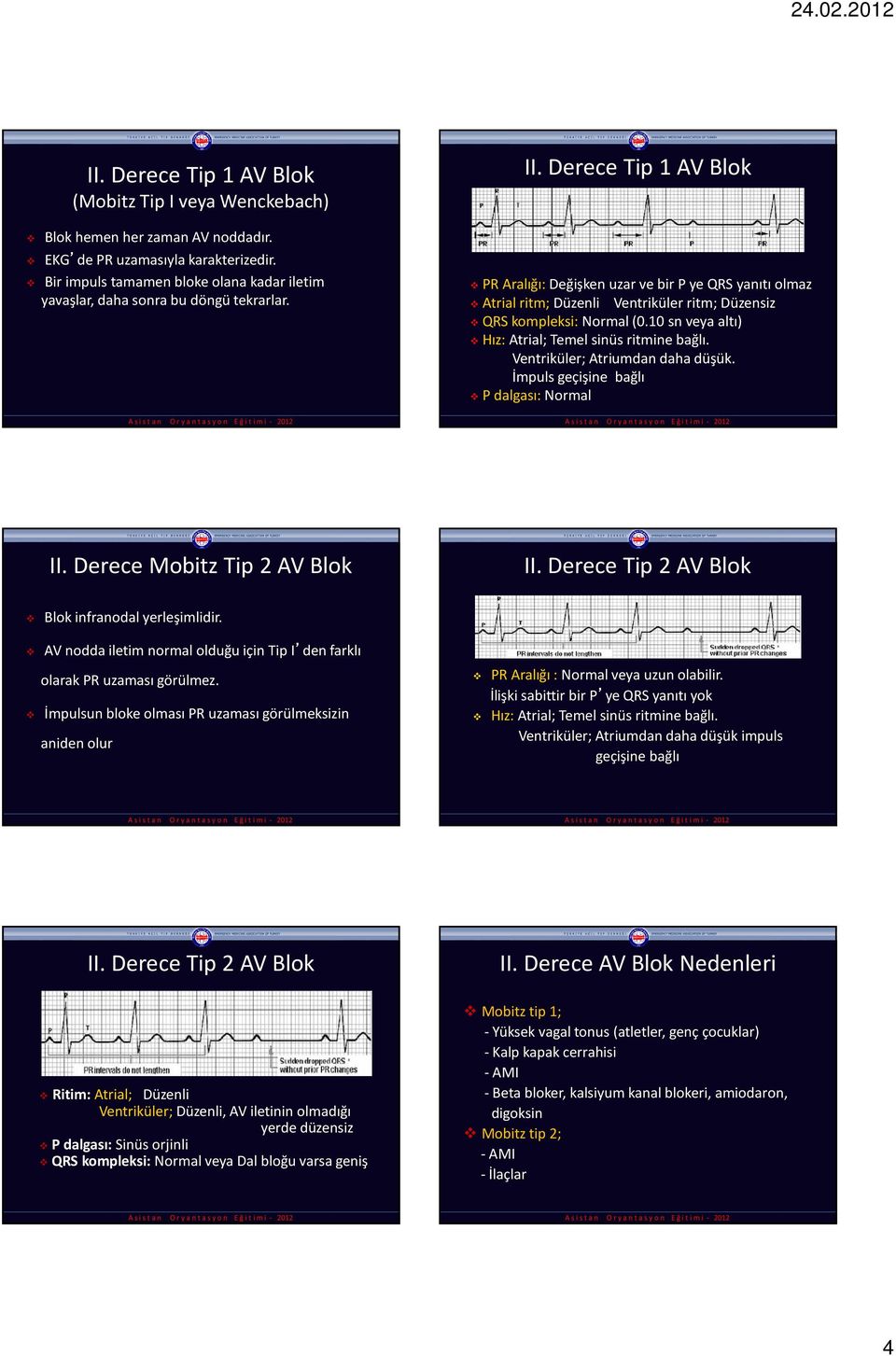 Derece Tip 1 AV Blok PR Aralığı:Değişken uzar ve bir P ye QRS yanıtı olmaz Atrial ritm; Düzenli Ventriküler ritm; Düzensiz QRS kompleksi: Normal (0.