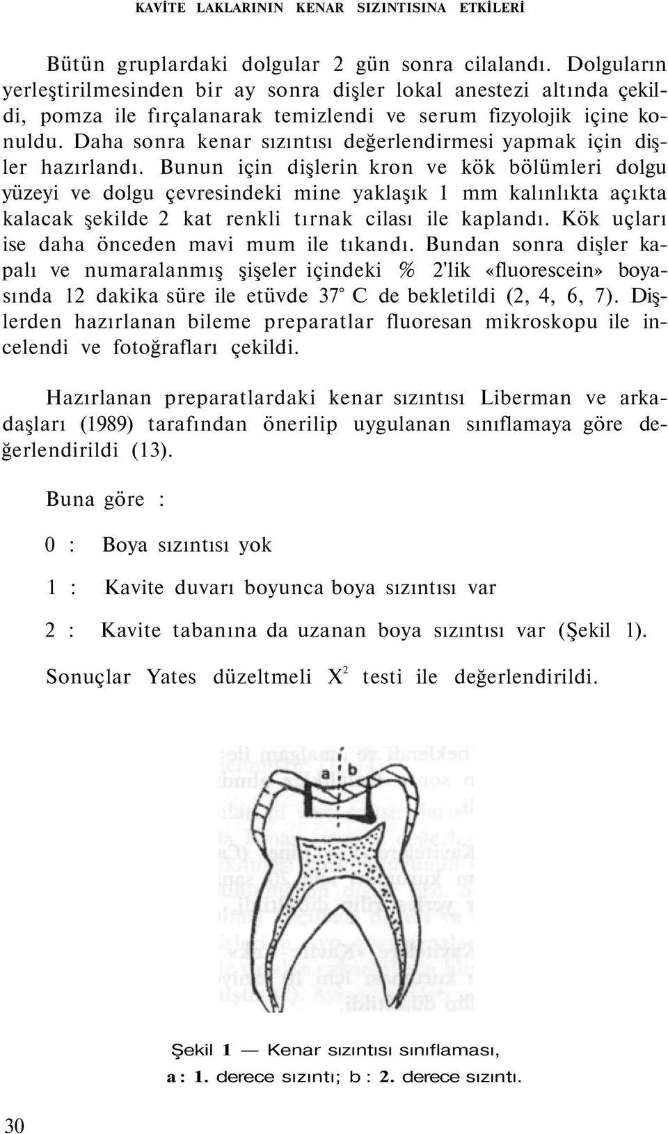 Daha sonra kenar sızıntısı değerlendirmesi yapmak için dişler hazırlandı.