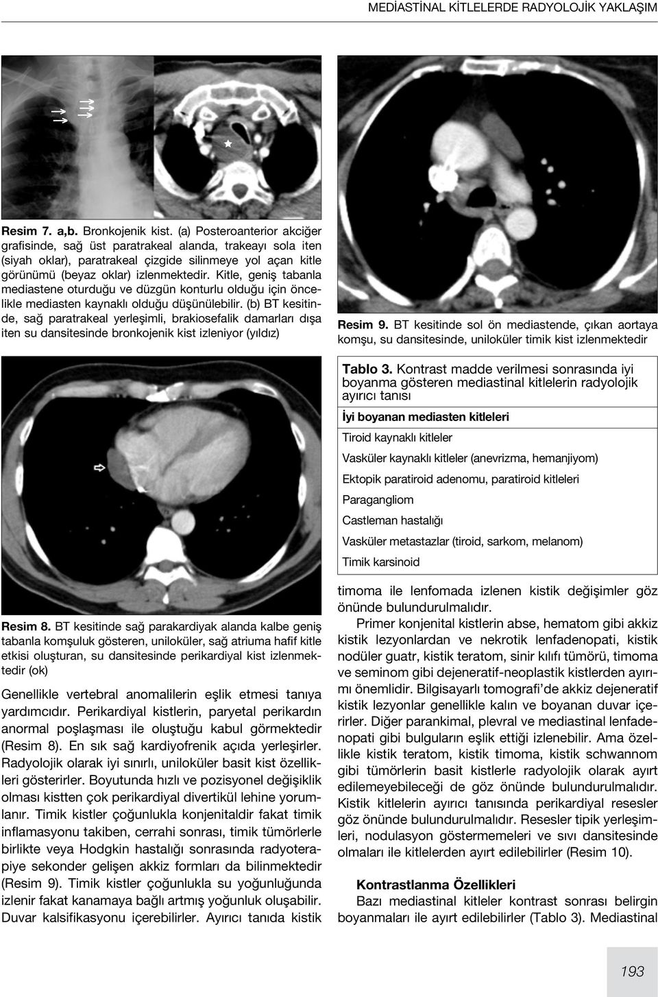 Kitle, geniş tabanla mediastene oturduğu ve düzgün konturlu olduğu için öncelikle mediasten kaynaklı olduğu düşünülebilir.