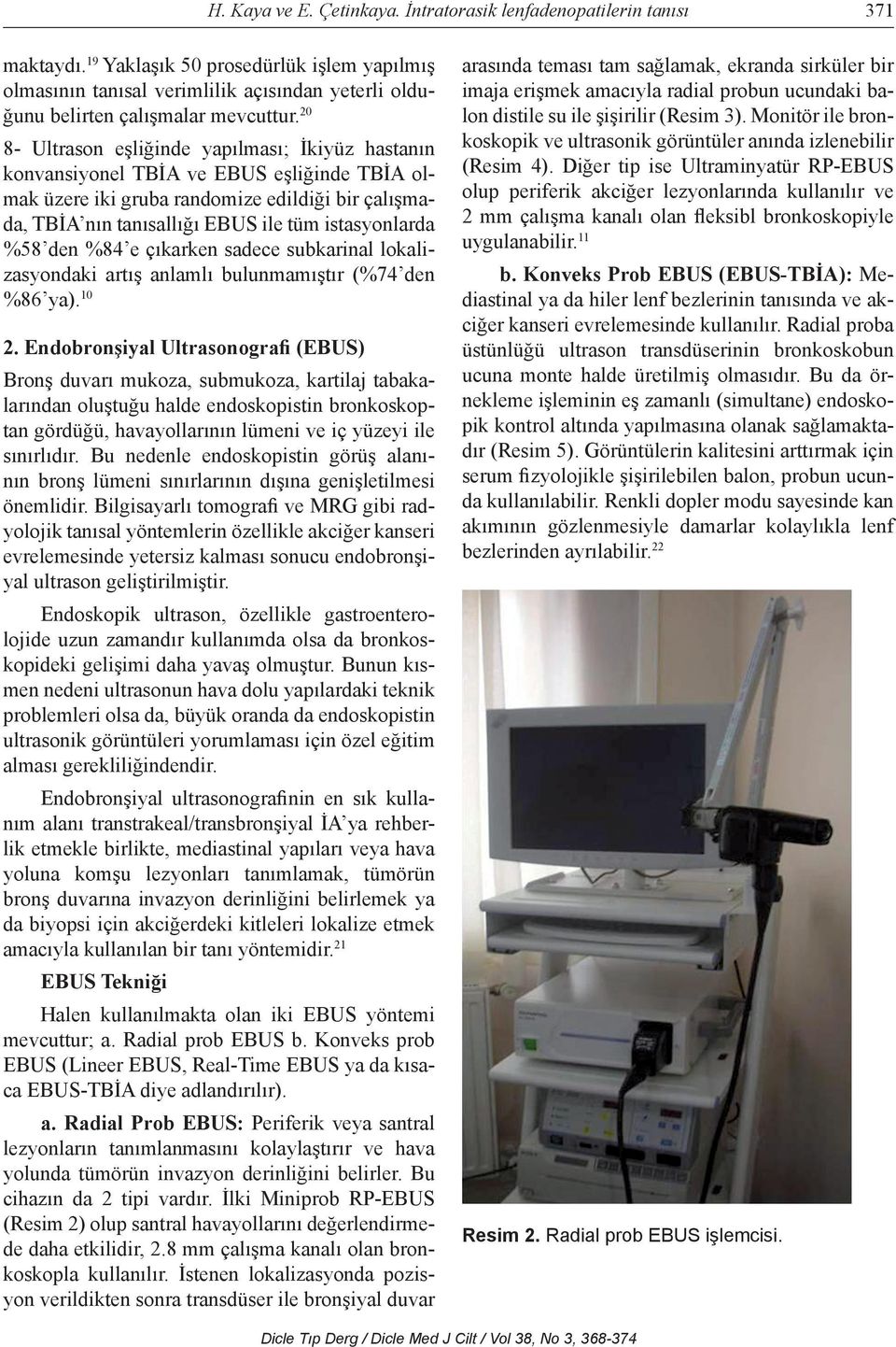 20 8- Ultrason eşliğinde yapılması; İkiyüz hastanın konvansiyonel TBİA ve EBUS eşliğinde TBİA olmak üzere iki gruba randomize edildiği bir çalışmada, TBİA nın tanısallığı EBUS ile tüm istasyonlarda