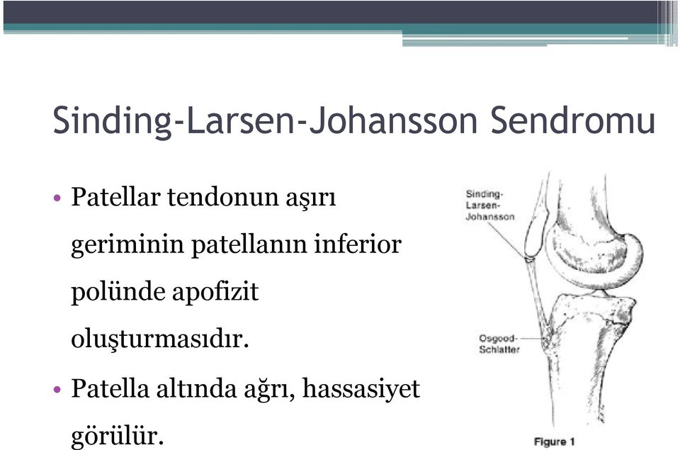patellanıninferior polünde apofizit