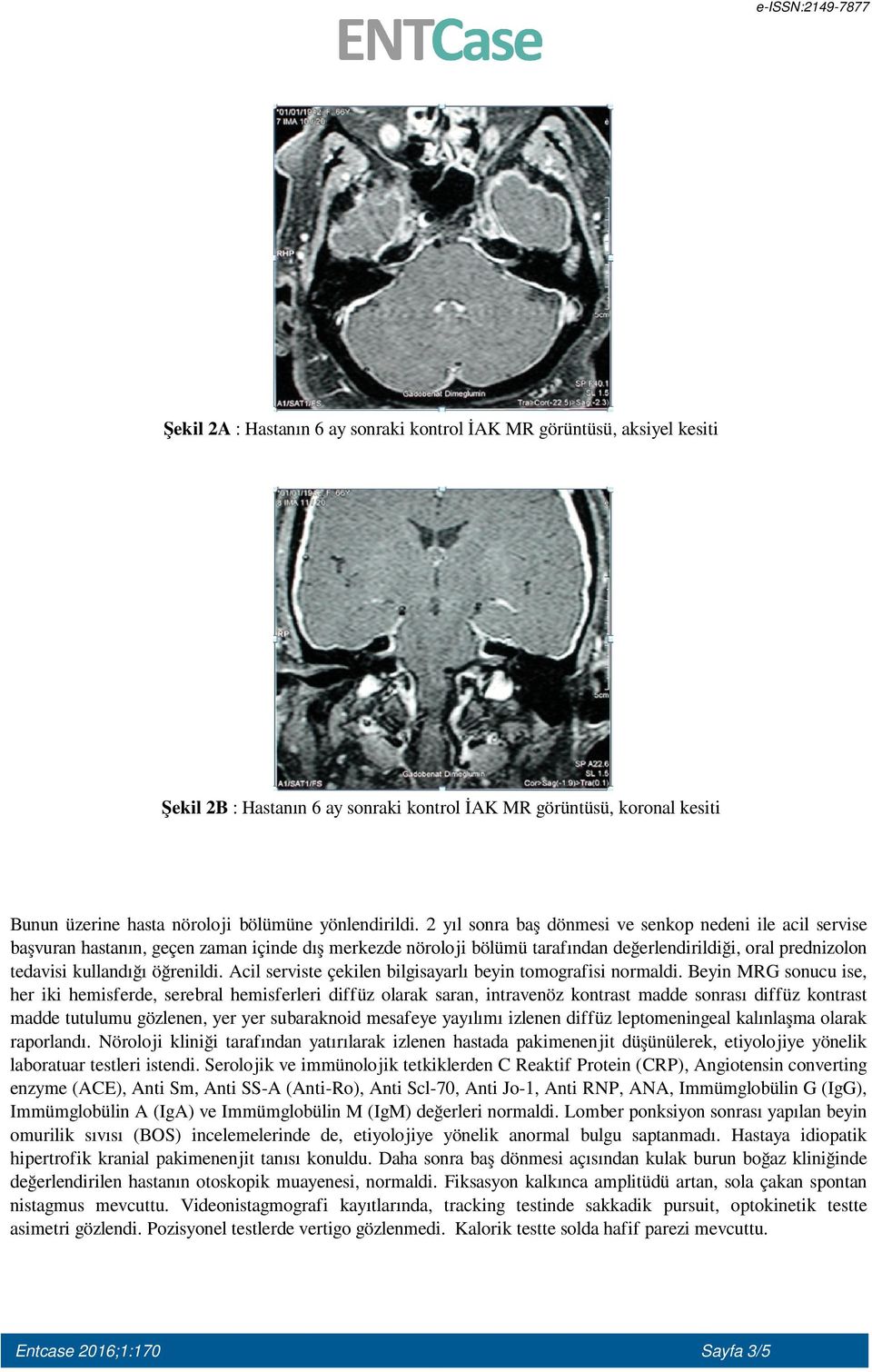 öğrenildi. Acil serviste çekilen bilgisayarlı beyin tomografisi normaldi.