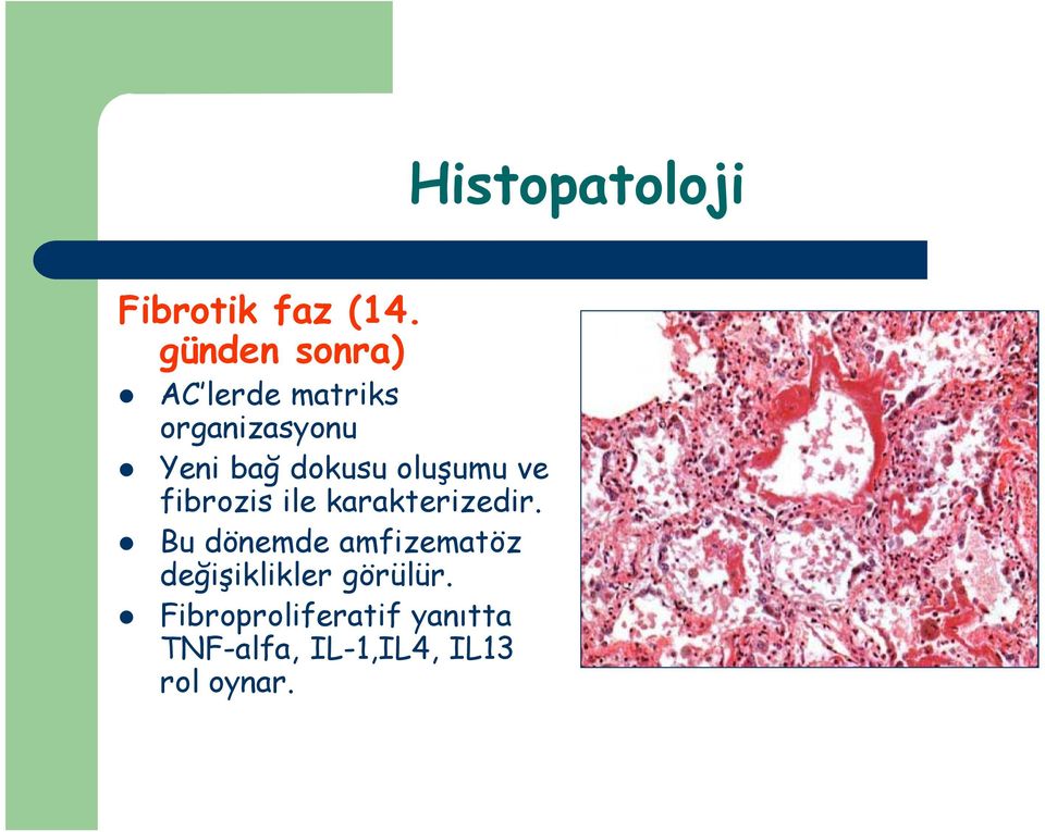 dokusu oluşumu ve fibrozis ile karakterizedir.