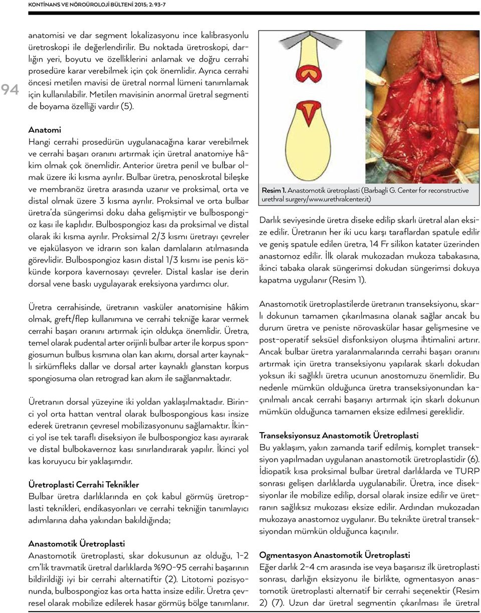 Ayrıca cerrahi öncesi metilen mavisi de üretral normal lümeni tanımlamak için kullanılabilir. Metilen mavisinin anormal üretral segmenti de boyama özelliği vardır (5).