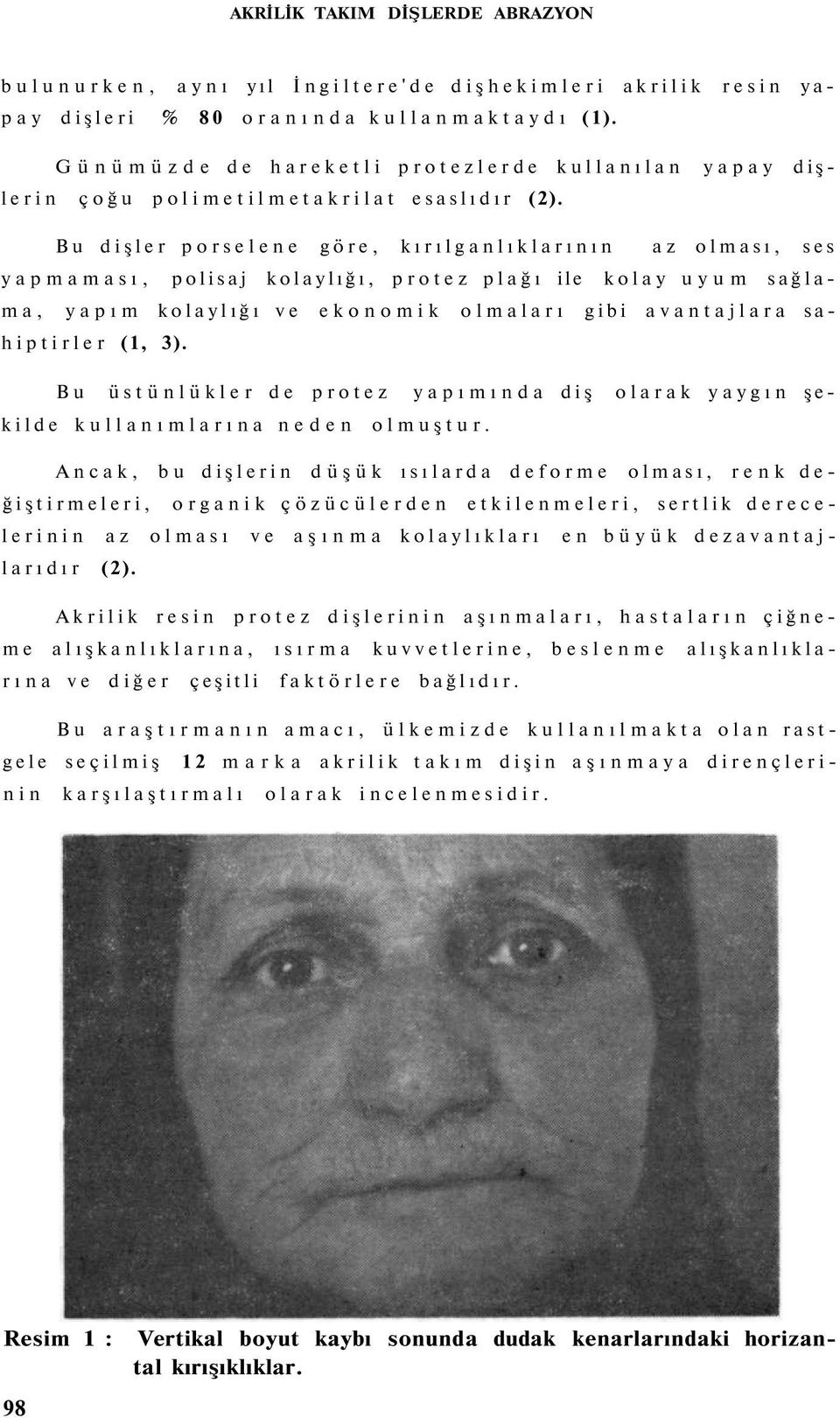 Bu dişler porselene göre, kırılganlıklarının az olması, ses yapmaması, polisaj kolaylığı, protez plağı ile kolay uyum sağlama, yapım kolaylığı ve ekonomik olmaları gibi avantajlara sahiptirler (1, 3).