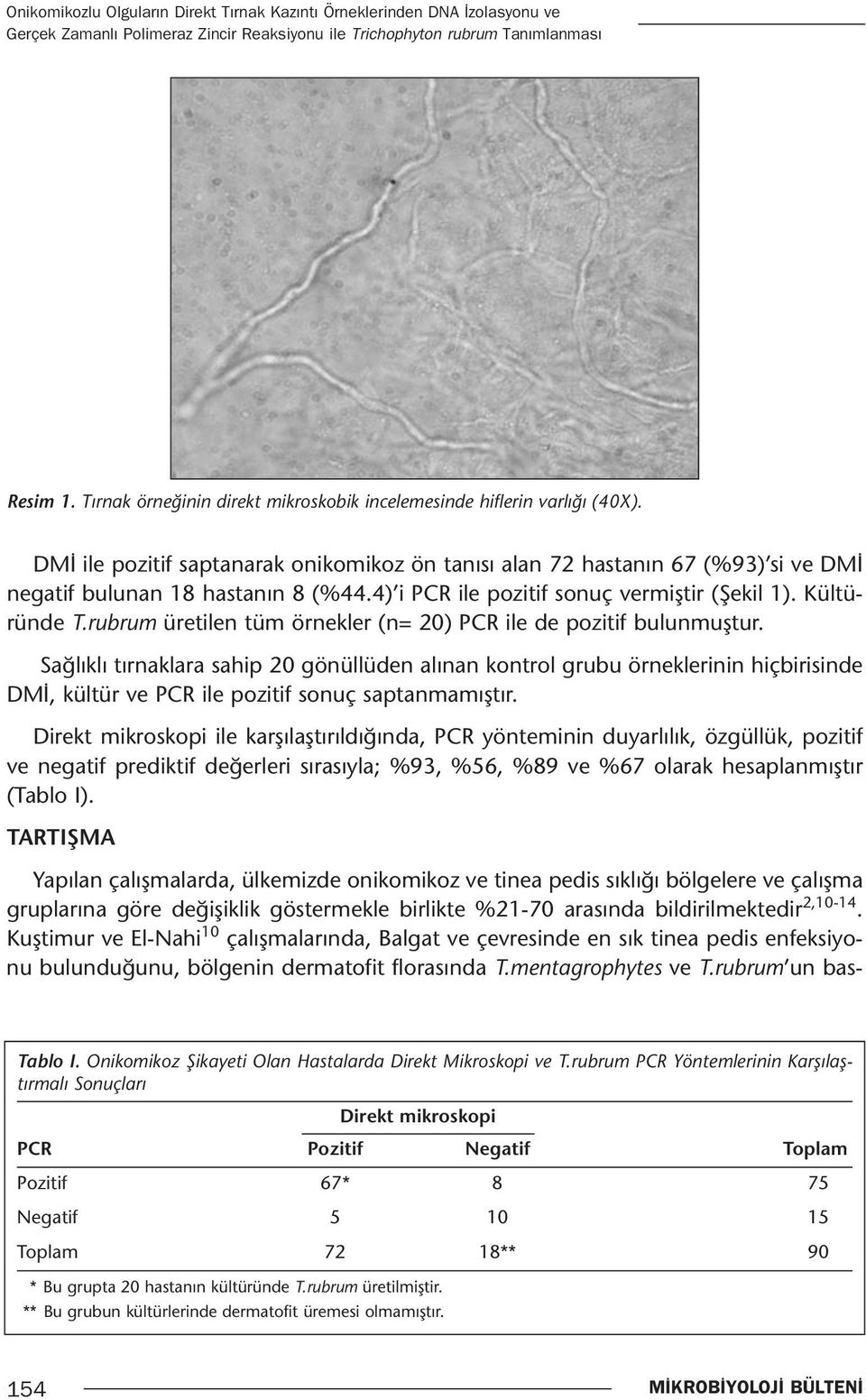 4) i PCR ile pozitif sonuç vermiştir (Şekil 1). Kültüründe T.rubrum üretilen tüm örnekler (n= 20) PCR ile de pozitif bulunmuştur.