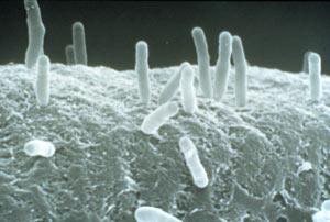 Agrobacterium tumefaciens Alem: Bacteria Şube: Proteobacteria Sınıf: Alpha Proteobacteria