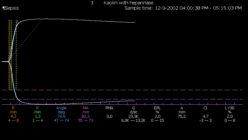 testlerle kolayca tanınır TEG / ROTEM / CT kısa