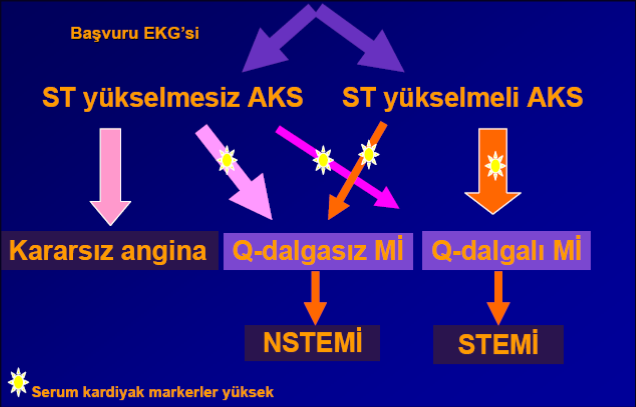 AKUT KORONER SENDROM (Stabil Olmayan Anjina Pektoris) AKS düşündüren iskemik semptomlar EKG değişikliği olabilir / olmayabilir yok (Geçici ST elevasyonu, depresyonu veya T dalgası negatifliği)