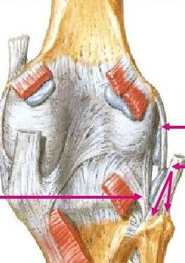 Resim 7: Diz arka yüzünde Gastrokinemius tendonunun, femur distal kondil arkasındaki yapışma yerleri Üstteki kısa ok: Lateral kollateral ligament,