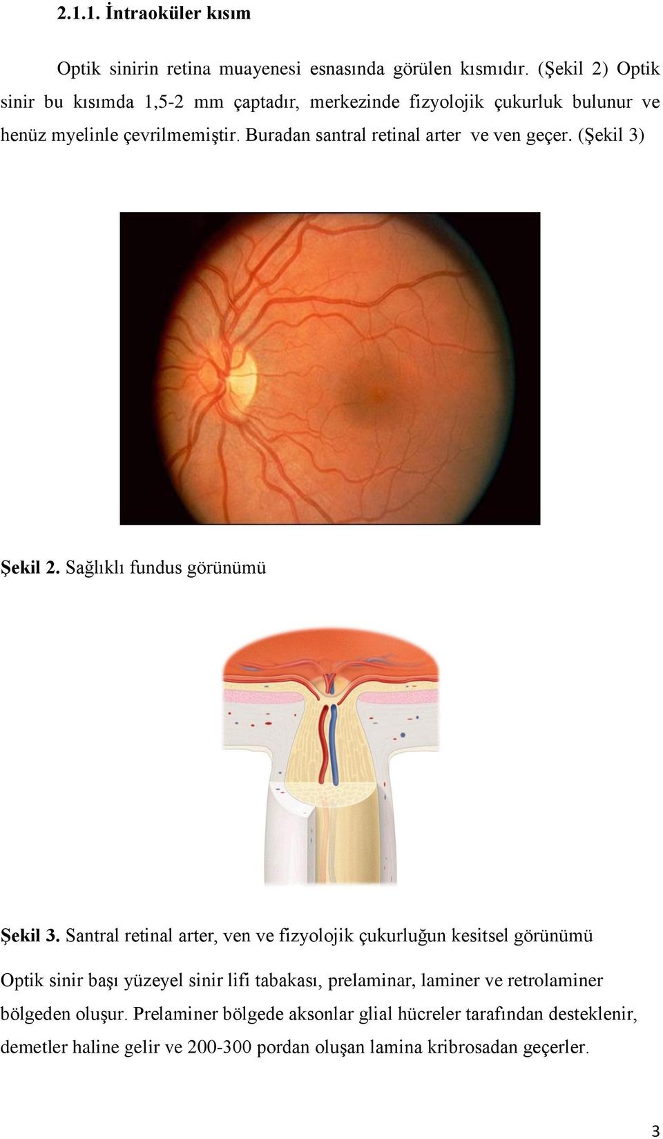 Buradan santral retinal arter ve ven geçer. (Şekil 3) ġekil 2. Sağlıklı fundus görünümü ġekil 3.