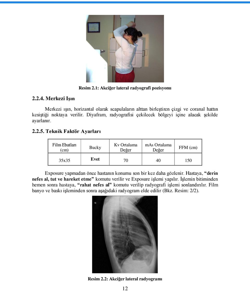 Teknik Faktör Ayarları Film Ebatları (cm) Bucky Kv Ortalama Değer mas Ortalama Değer FFM (cm) 35x35 Evet 70 40 150 Exposure yapmadan önce hastanın konumu son bir kez daha gözlenir.
