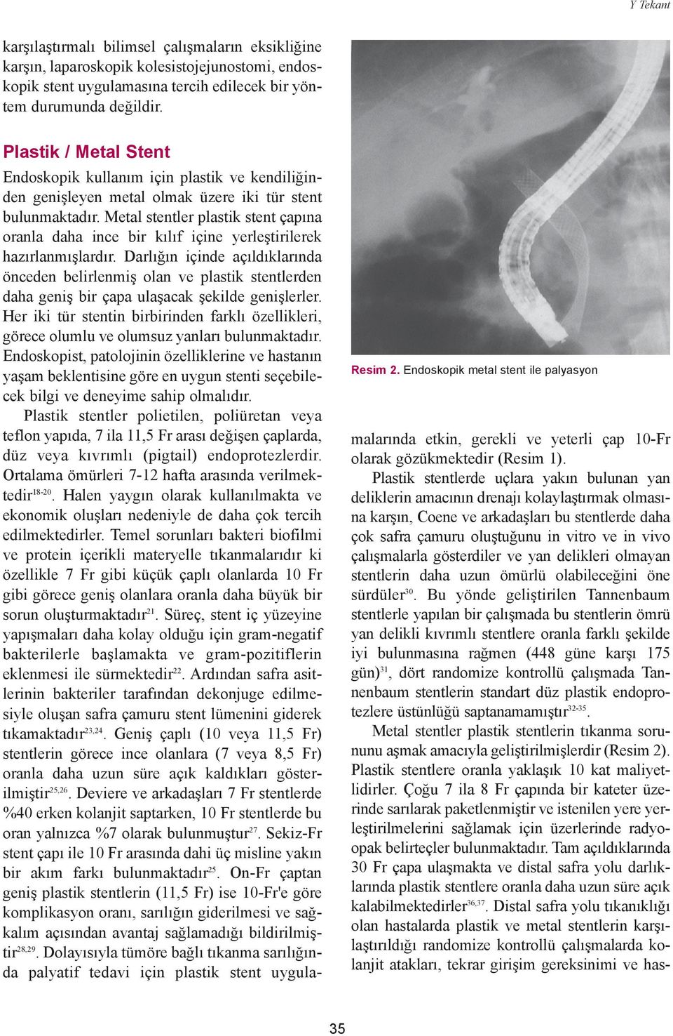 Metal stentler plastik stent çapýna oranla daha ince bir kýlýf içine yerleþtirilerek hazýrlanmýþlardýr.