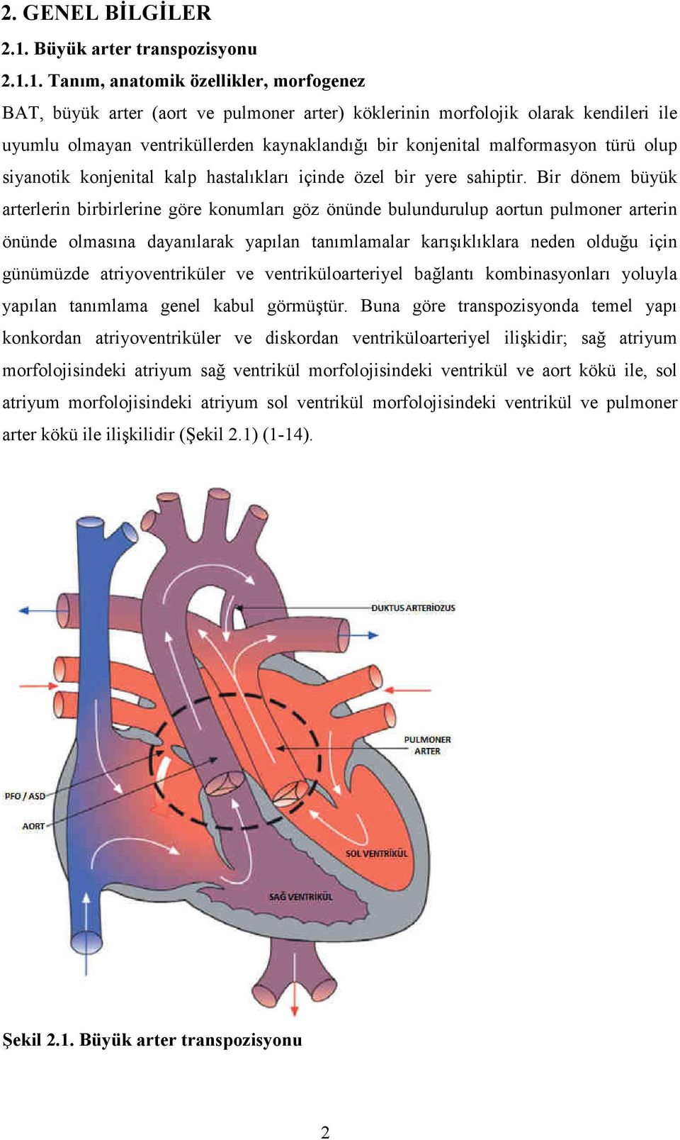 1. Tanım, anatomik özellikler, morfogenez BAT, büyük arter (aort ve pulmoner arter) köklerinin morfolojik olarak kendileri ile uyumlu olmayan ventriküllerden kaynaklandığı bir konjenital malformasyon