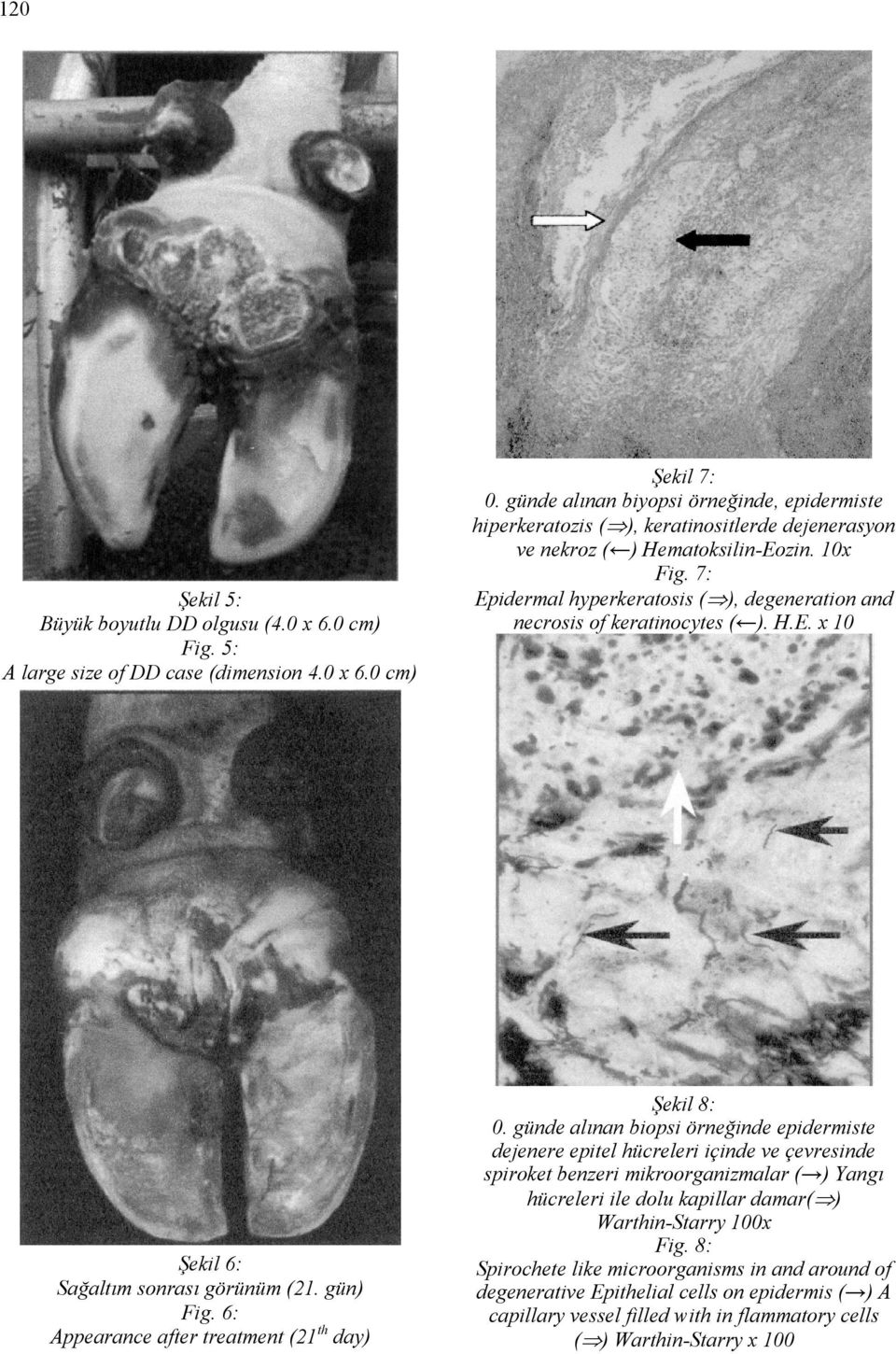 7: Epidermal hyperkeratosis ( ), degeneration and necrosis of keratinocytes ( ). H.E. x 10 Şekil 8: 0.
