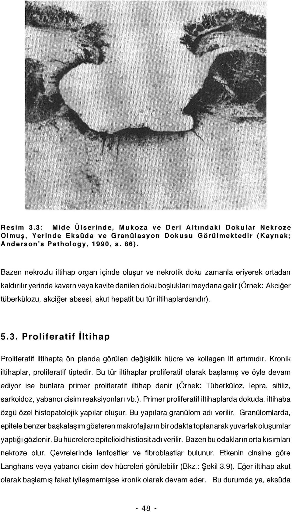 absesi, akut hepatit bu tür iltihaplardandır). 5.3. Proliferatif İltihap Proliferatif iltihapta ön planda görülen değişiklik hücre ve kollagen lif artımıdır. Kronik iltihaplar, proliferatif tiptedir.