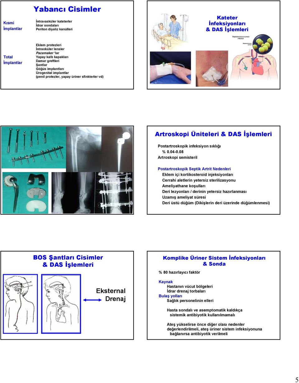 08 Artroskopi semisteril Postartroskopik Septik Artrit Nedenleri Eklem içi kortikosteroid injeksiyonları Cerrahi aletlerin yetersiz sterilizasyonu Ameliyathane koşulları Deri lezyonları / derinin