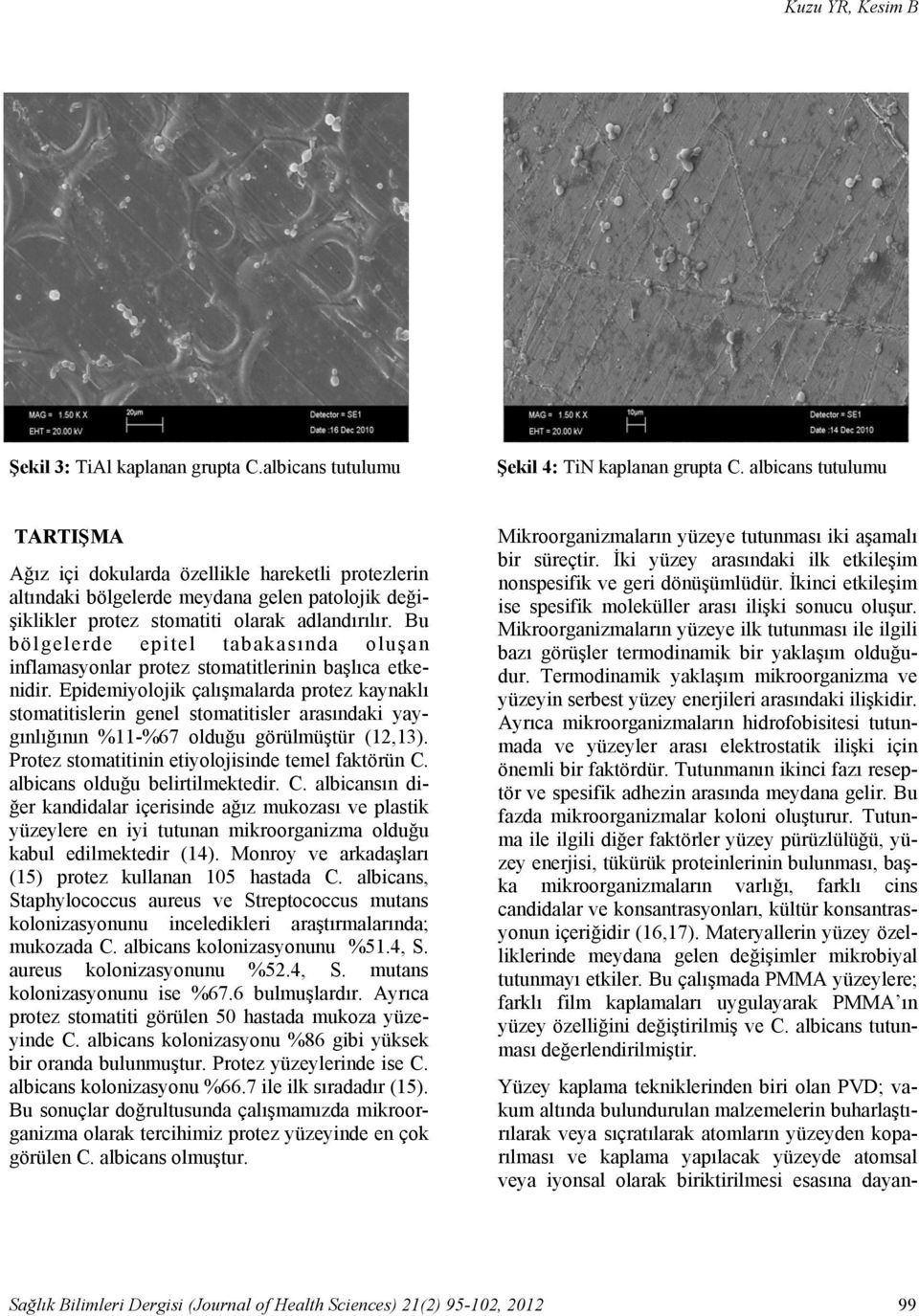 Bu bölgelerde epitel tabakasında oluşan inflamasyonlar protez stomatitlerinin başlıca etkenidir.