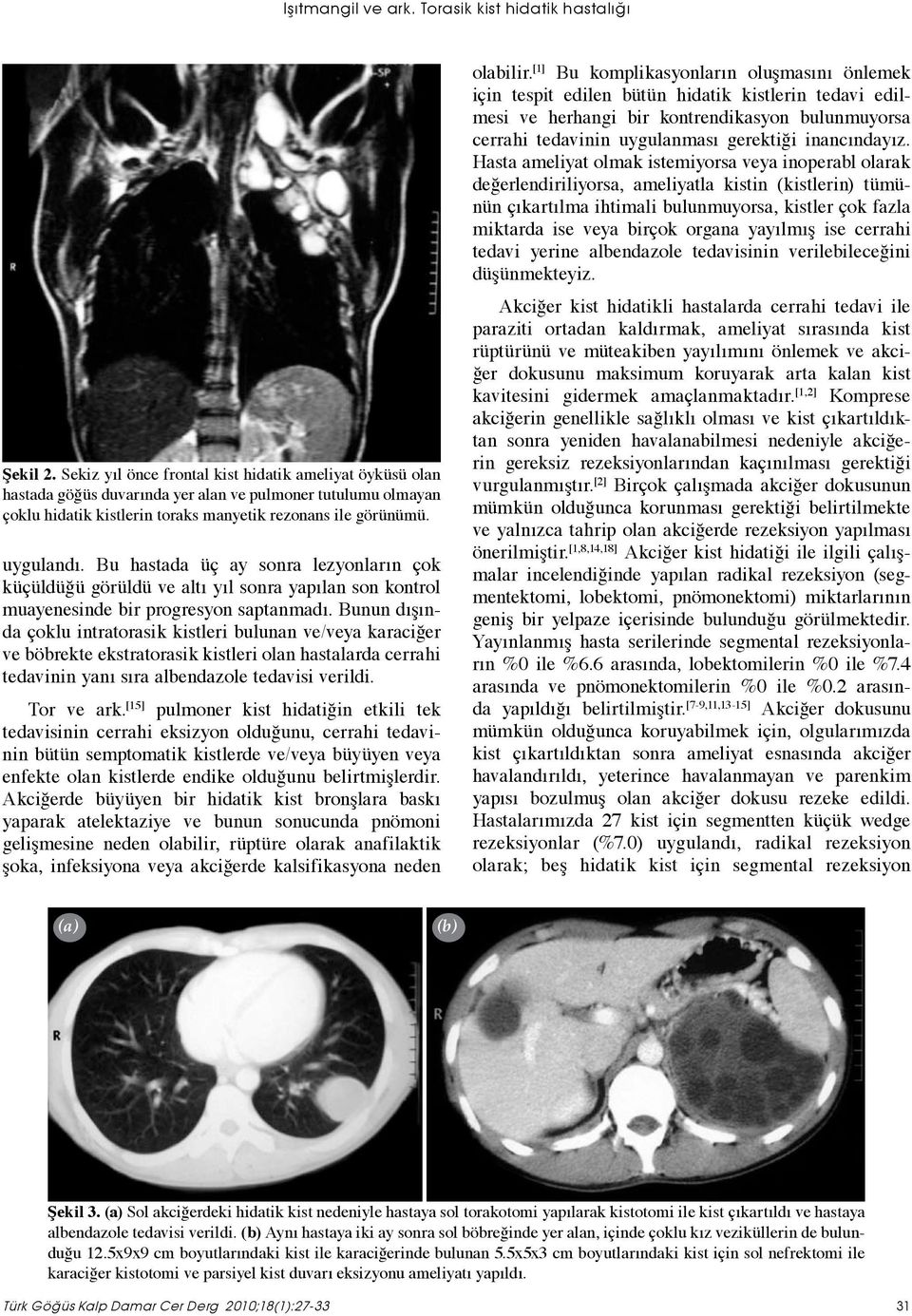 Bu hastada üç ay sonra lezyonların çok küçüldüğü görüldü ve altı yıl sonra yapılan son kontrol muayenesinde bir progresyon saptanmadı.