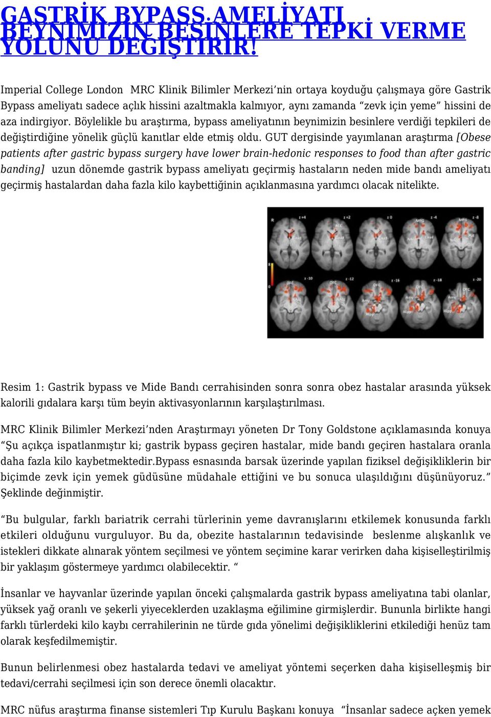 indirgiyor. Böylelikle bu araştırma, bypass ameliyatının beynimizin besinlere verdiği tepkileri de değiştirdiğine yönelik güçlü kanıtlar elde etmiş oldu.