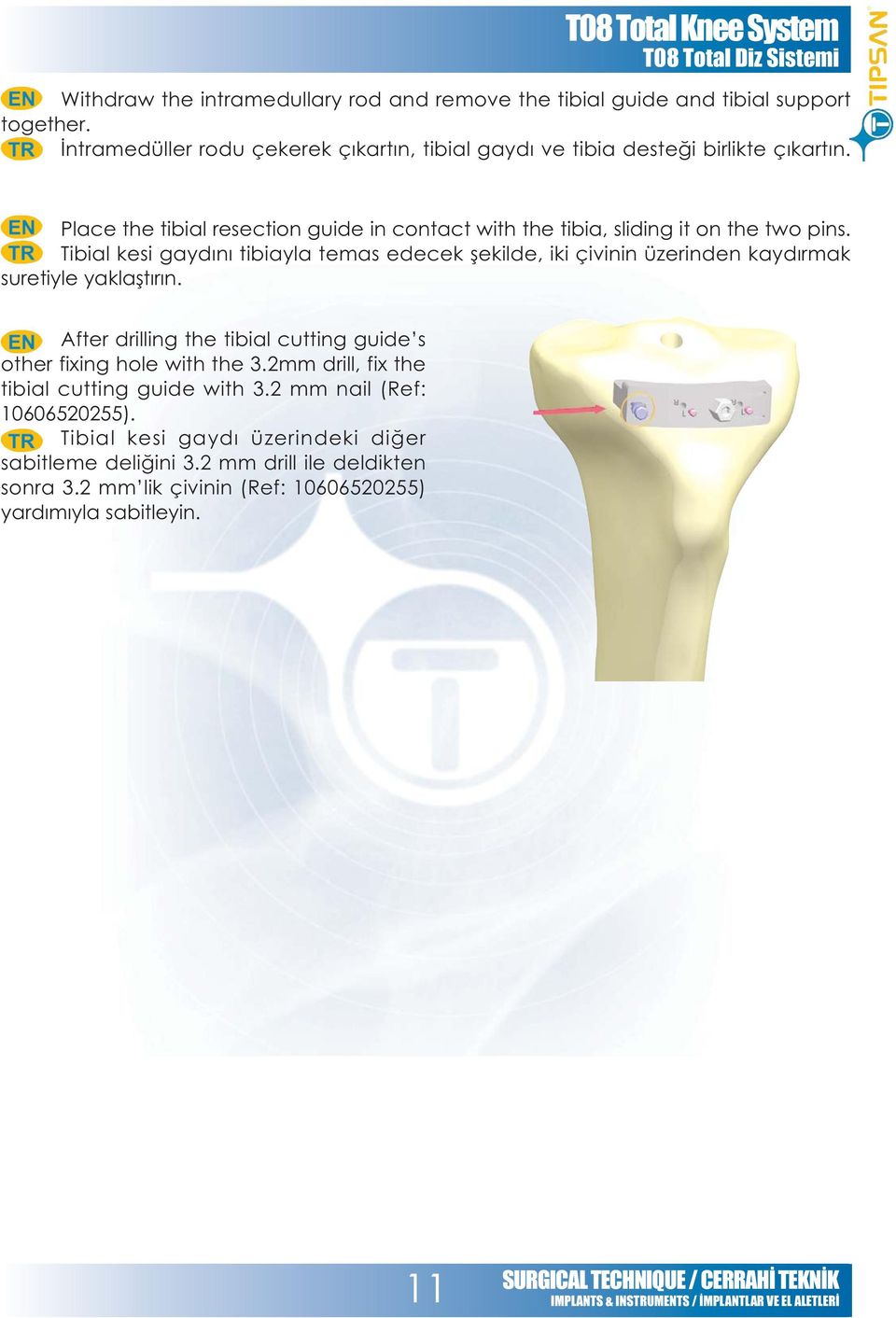 Place the tibial resection guide in contact with the tibia, sliding it on the two pins.