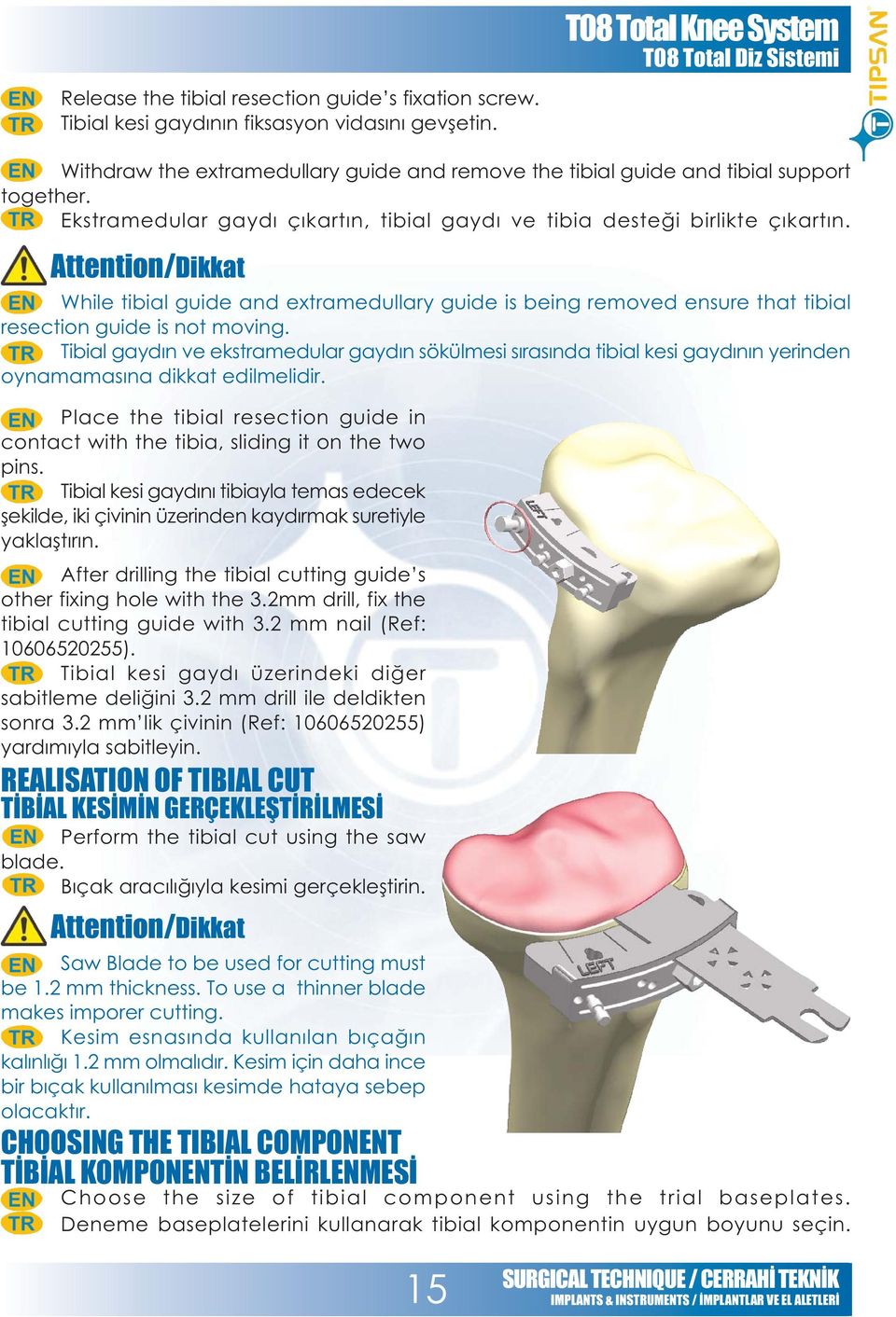 Attention/Dikkat While tibial guide and extramedullary guide is being removed ensure that tibial resection guide is not moving.