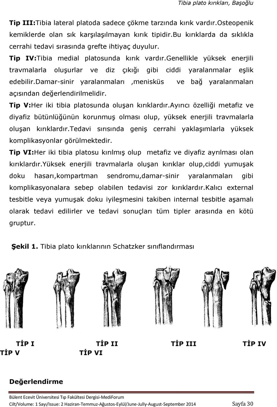 damar-sinir yaralanmaları,menisküs ve bağ yaralanmaları açısından değerlendirilmelidir. Tip V:Her iki tibia platosunda oluşan kırıklardır.