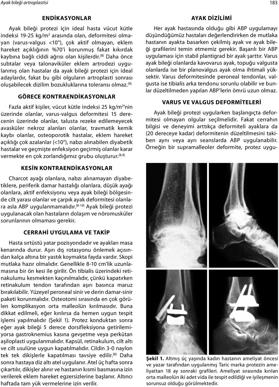 [8] Daha önce subtalar veya talonaviküler eklem artrodezi uygulanmış olan hastalar da ayak bileği protezi için ideal adaylardır, fakat bu gibi olguların artroplasti sonrası oluşabilecek dizilim