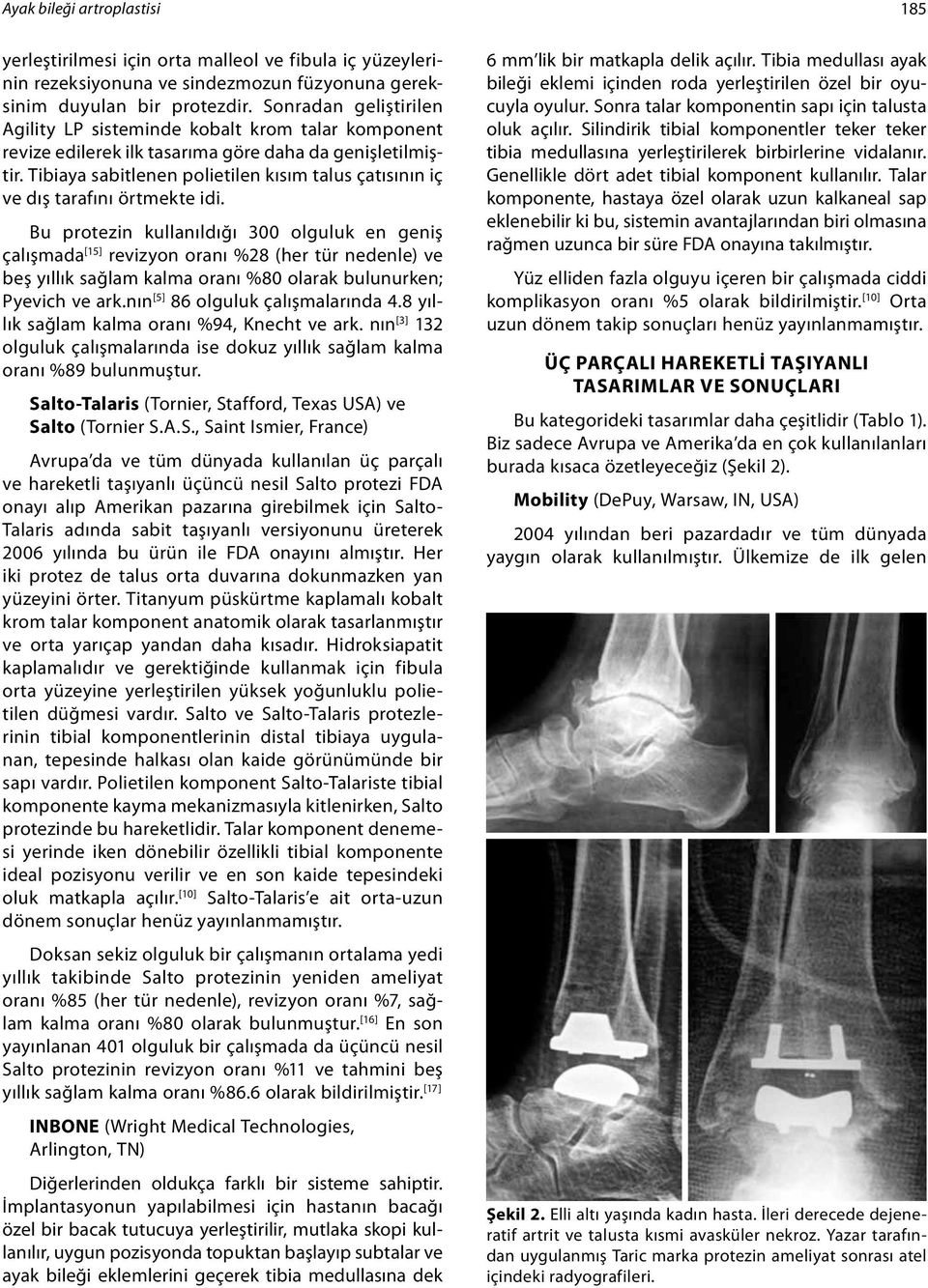 Tibiaya sabitlenen polietilen kısım talus çatısının iç ve dış tarafını örtmekte idi.