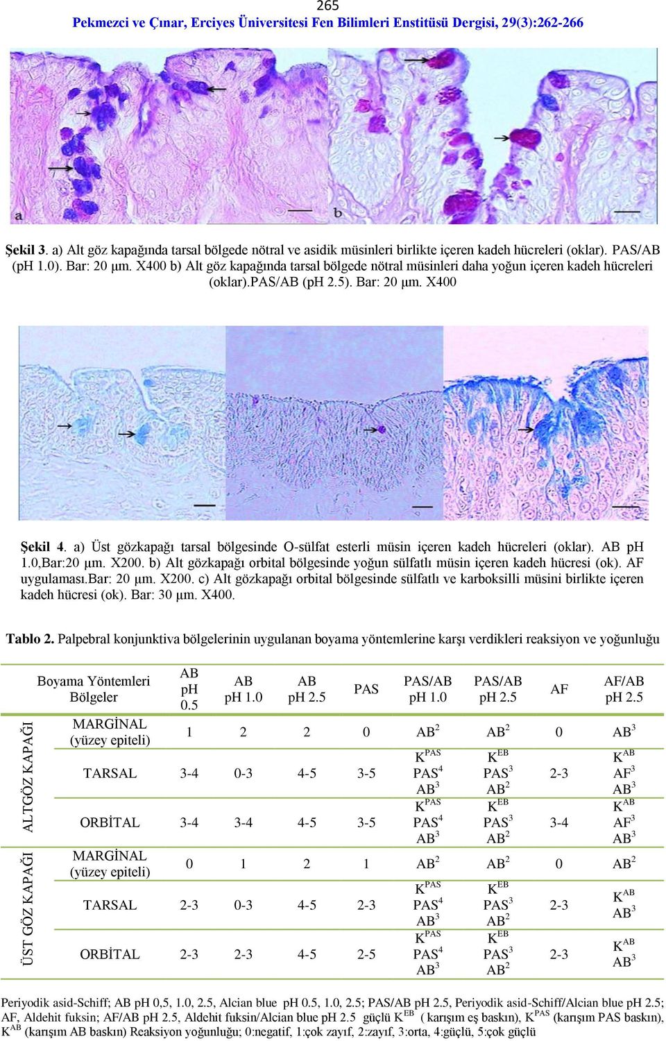 a) Üst gözkapağı tarsal bölgesinde O-sülfat esterli müsin içeren kadeh hücreleri (oklar). ph 1.0,Bar:20 µm. X200. b) Alt gözkapağı orbital bölgesinde yoğun sülfatlı müsin içeren kadeh hücresi (ok).