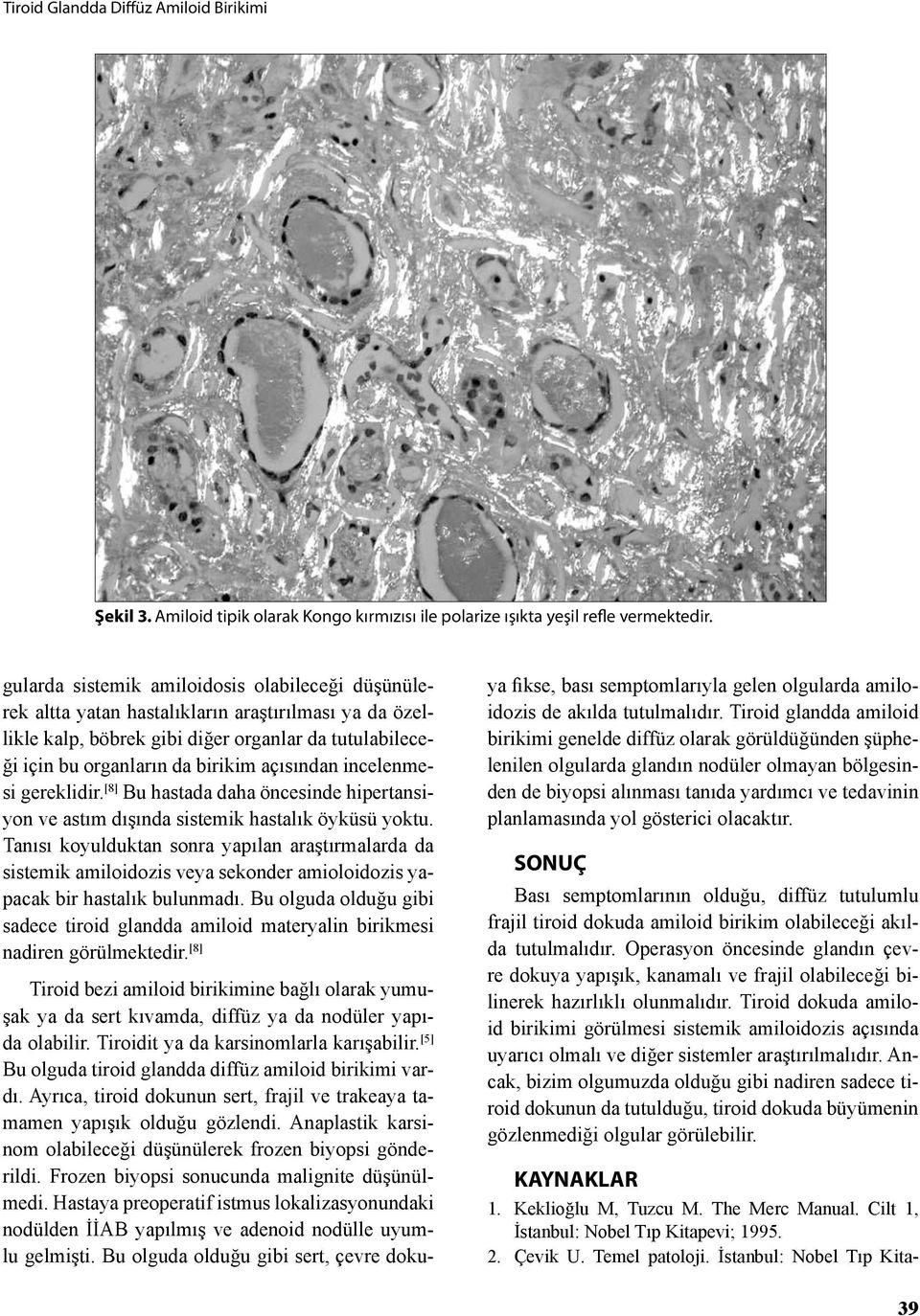 incelenmesi gereklidir. [8] Bu hastada daha öncesinde hipertansiyon ve astım dışında sistemik hastalık öyküsü yoktu.