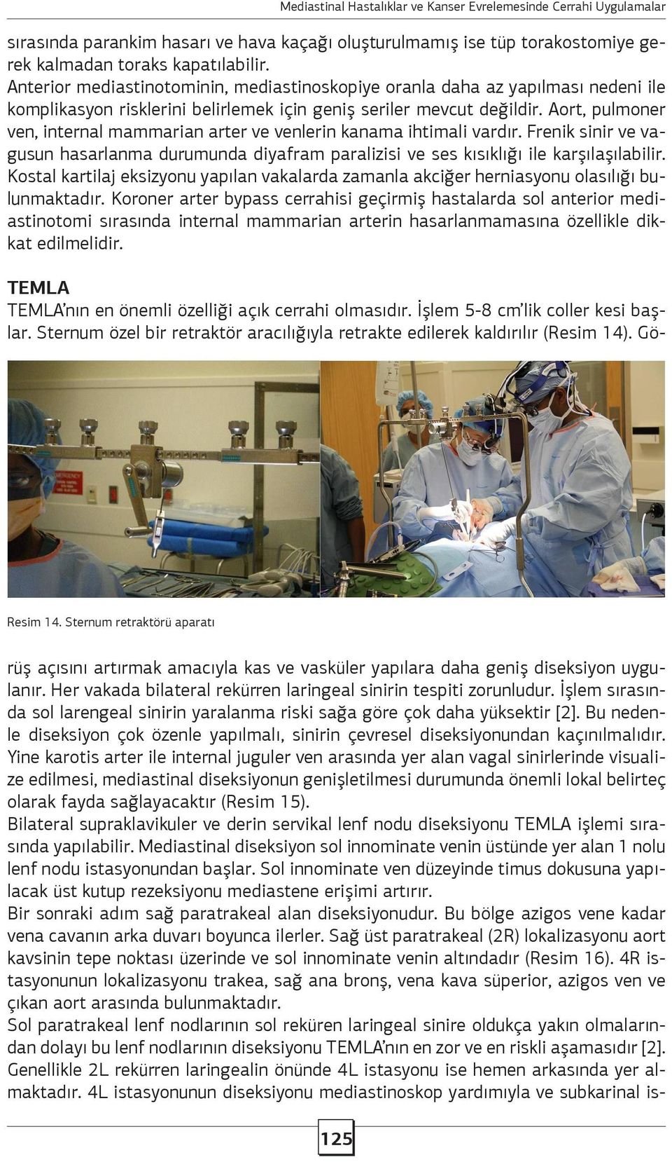 Aort, pulmoner ven, internal mammarian arter ve venlerin kanama ihtimali vardır. Frenik sinir ve vagusun hasarlanma durumunda diyafram paralizisi ve ses kısıklığı ile karşılaşılabilir.