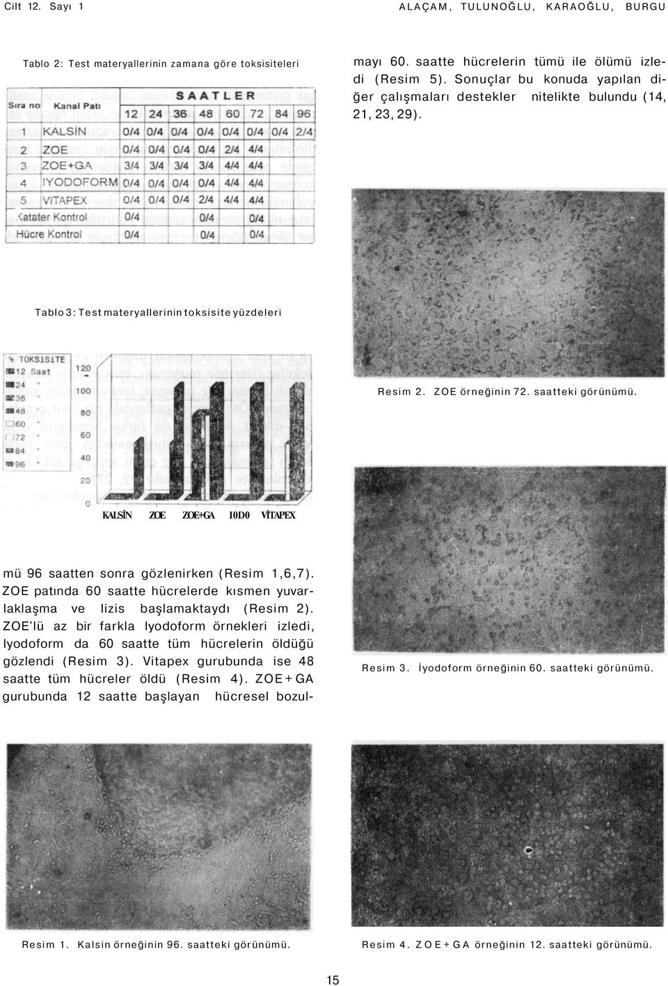 KALSİN ZOE ZOE+GA I0D0 VİTAPEX mü 96 saatten sonra gözlenirken (Resim 1,6,7). ZOE patında 60 saatte hücrelerde kısmen yuvarlaklaşma ve lizis başlamaktaydı (Resim 2).
