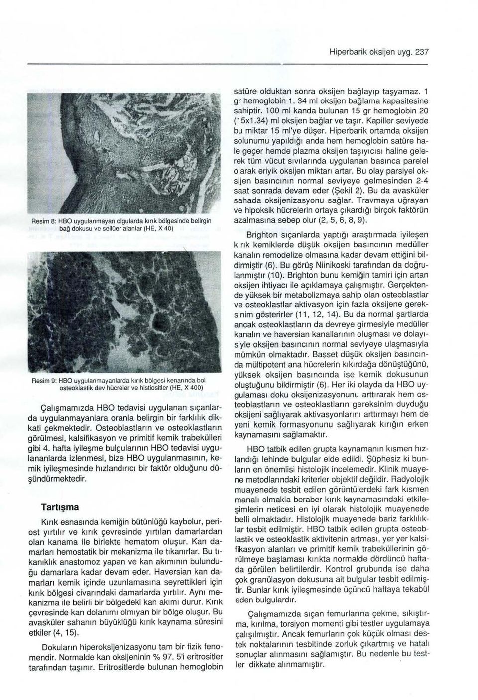 histiositler (HE, X 400) Çalışmamızda HBO tedavisi uygulanan sıçanlarda uygulanmayanlara oranla belirgin bir farklılık dikkati çekmektedir.