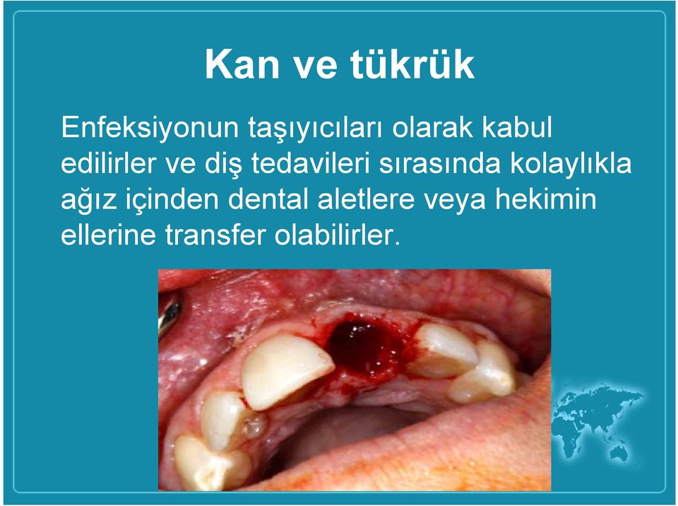 sırasında kolaylıkla ağız içinden dental